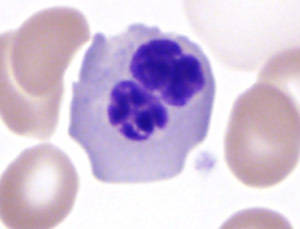 Fig 1K PB circulating normoblast